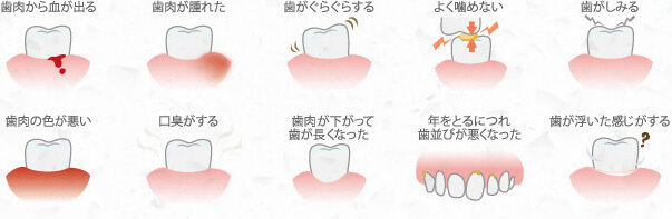 歯周病の症状