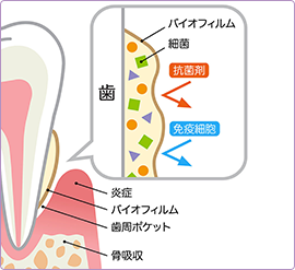 世界水準の予防プログラムGBT®